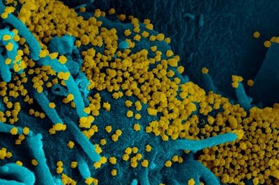  Quante varianti di coronavirus abbiamo individuato 