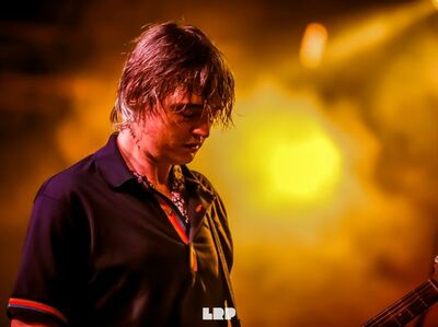  √ Pete Doherty e il Diabete: dita dei piedi a rischio amputazione 