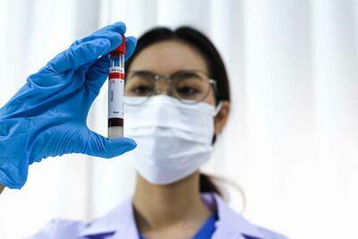  Covid-19, occhio a questo sintomo a dicembre: se lo riconosci subito ti salvi in tempo