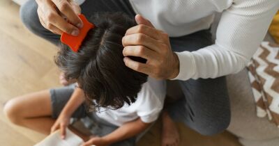 Come togliere i pidocchi in casa? Queste sono le soluzioni più sicure 
