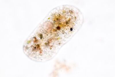  Amebe: cosa sono? Dove si trovano e quali malattie possono causare 