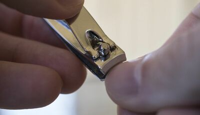 Melanoma, attenzione anche alle unghie: i campanelli d 'Allarme 