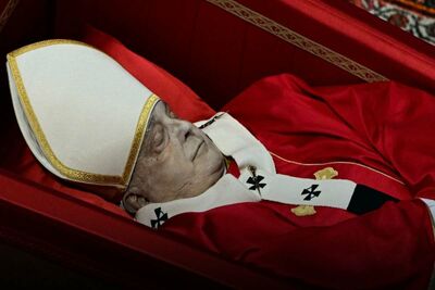  La strana macchia scura apparsa sul viso di Papa Francesco: ecco Cosa potrebbe essere 