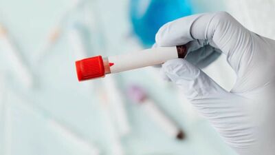  I test allergici sono importanti perché potrebbero salvarti la vita: come farli e Quanto costano 