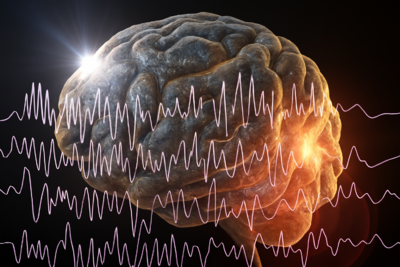  Epilessia rara: un farmaco taglia le crisi del 91% 