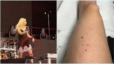  Taylor Momsen di «Gossip Girl» morsa da un pipistrello sul palco prima del concerto degli AC/DC 